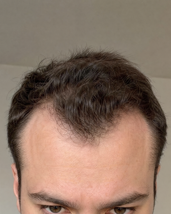 Marcus D., 29 before