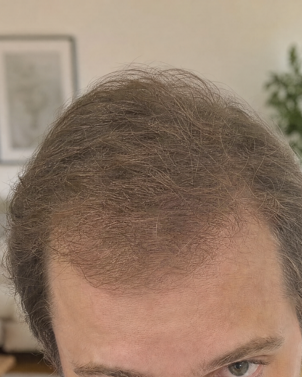 David L. after